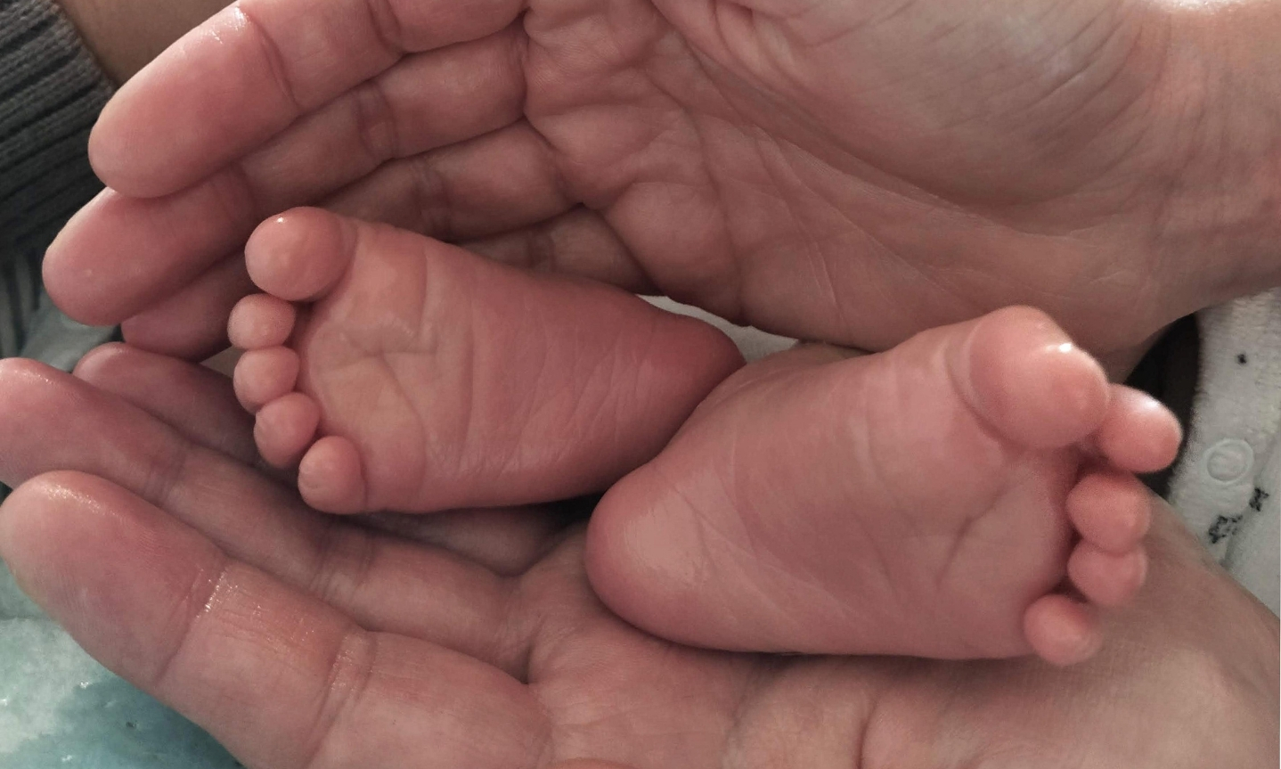 Build Birth Injury Case